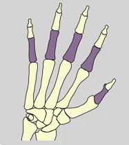 Bones of the body