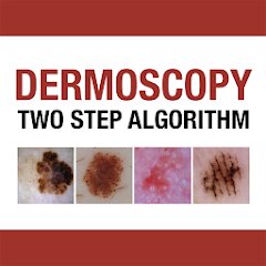 Dermoscopy Two Step Algorithm 